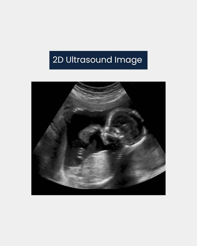 2D Ultrasound Machine Image