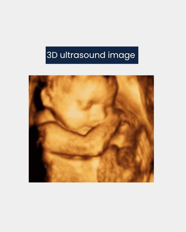 3D ultrasound machines