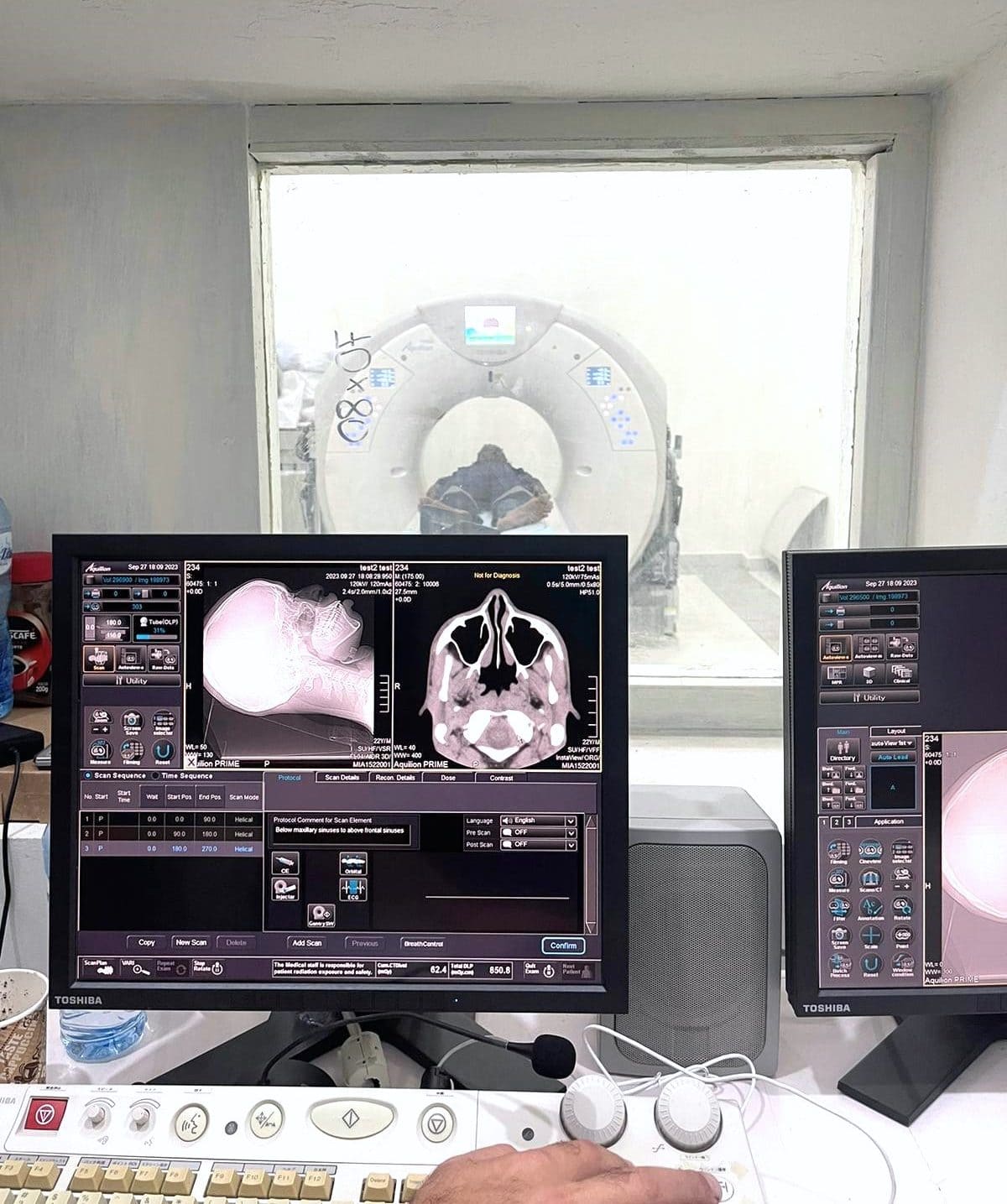 CT scanner view station. CT scanner workstation. LBN Medical. First CT scan.