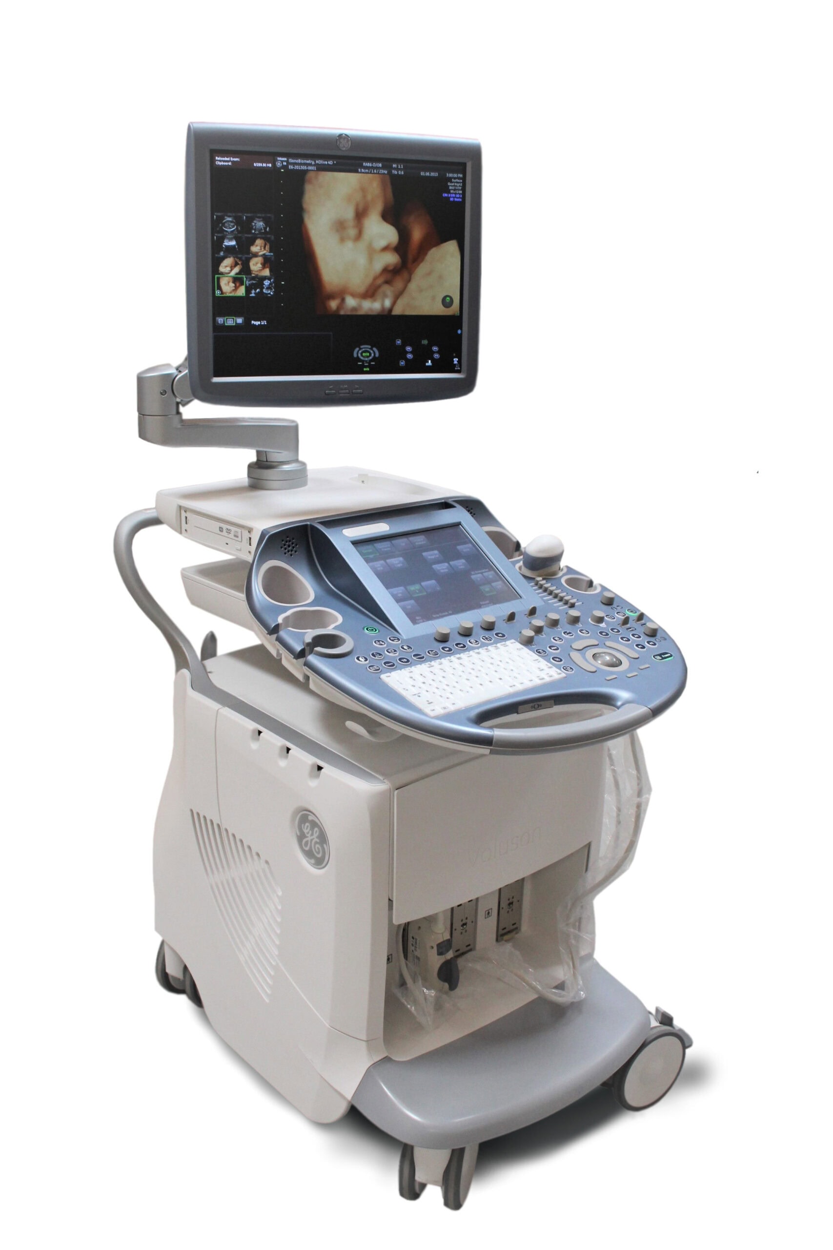 GE Voluson E6 Ultrasound machine