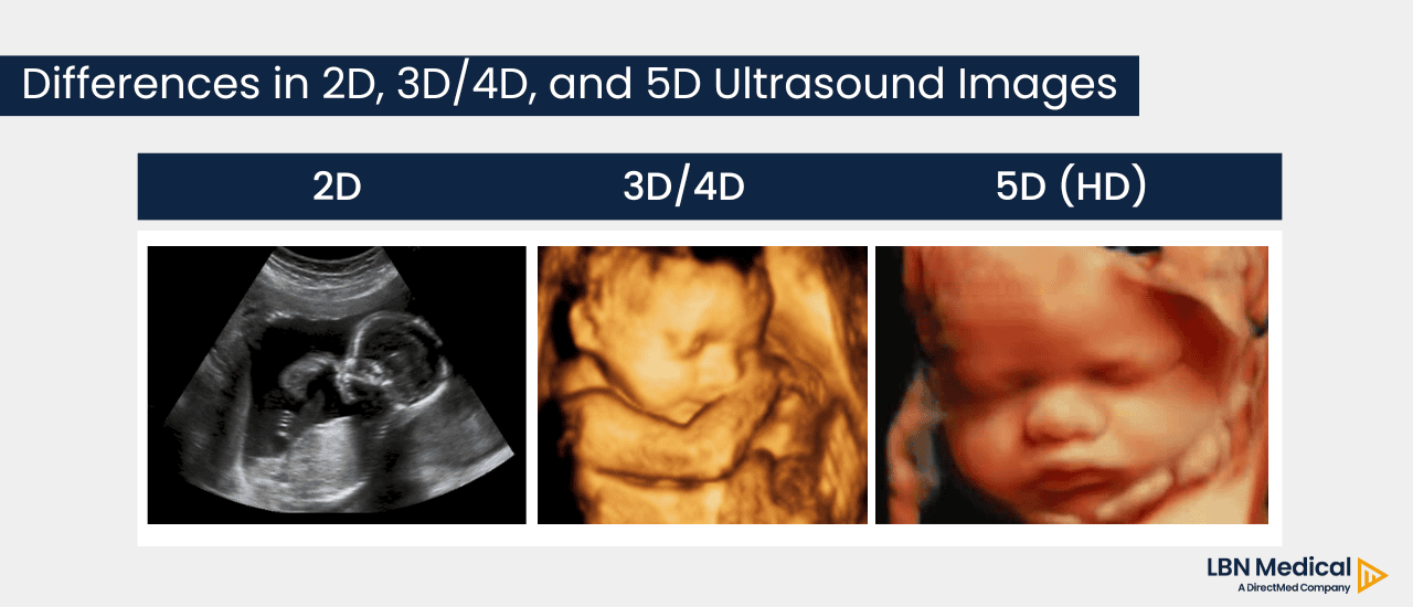 Differences in 3D ultrasound machines, 4D, 5D and 2D ultrasound images