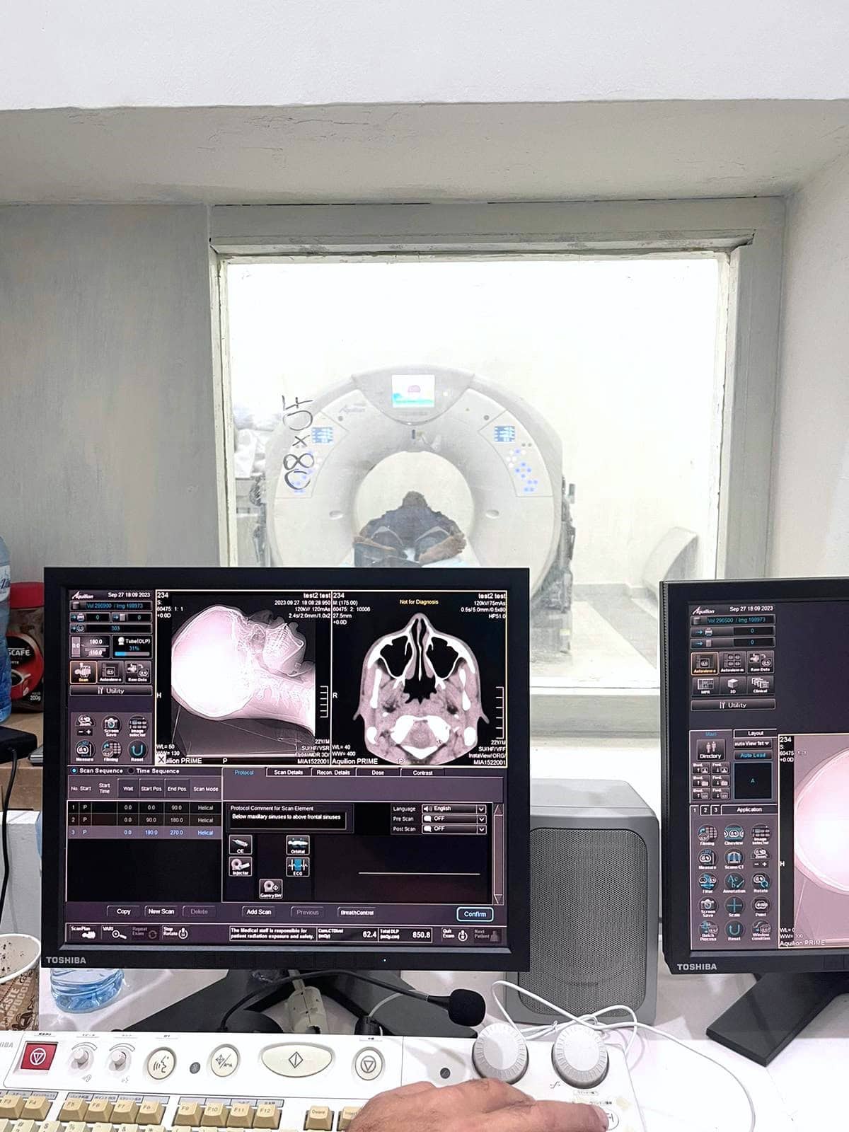 CT scanner viewing station. Pictures from our CT customer.